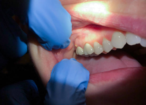 Best Walk-In Emergency Dental Services in New Sharon, IA
