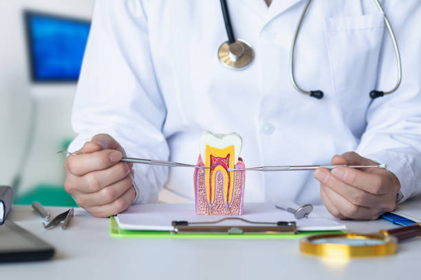 Best Knocked-Out Tooth (Avulsed Tooth) Treatment in New Sharon, IA